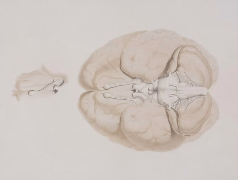 Beyin Sapı Tümörü