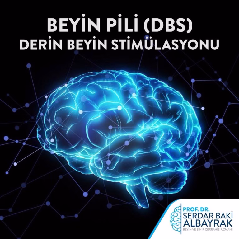 Parkinson Tedavisinde Derin Beyin Stimülasyonu (Beyin Pili) Uygulaması