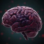 kötü huylu beyin tümörü belirtileri